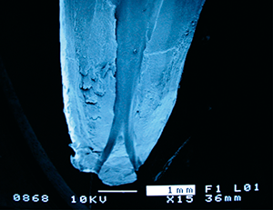 根管の顕微鏡像